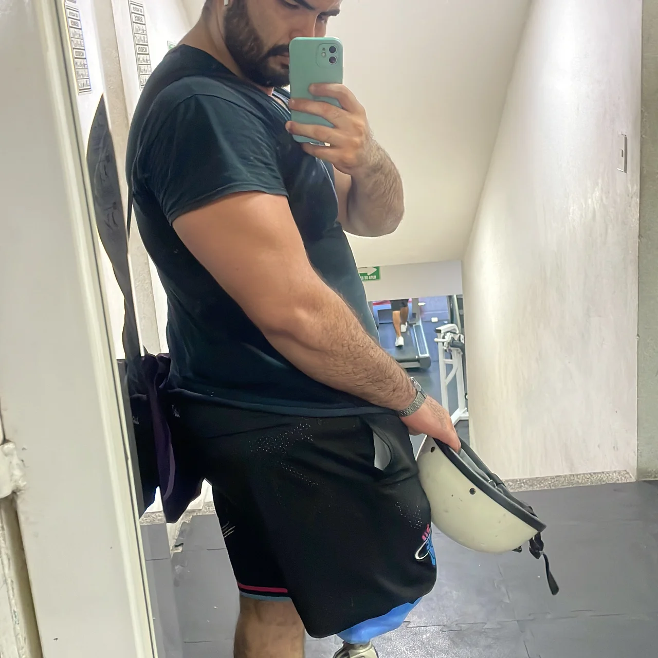 Alberto R AMPUTEE - OnlyFans model