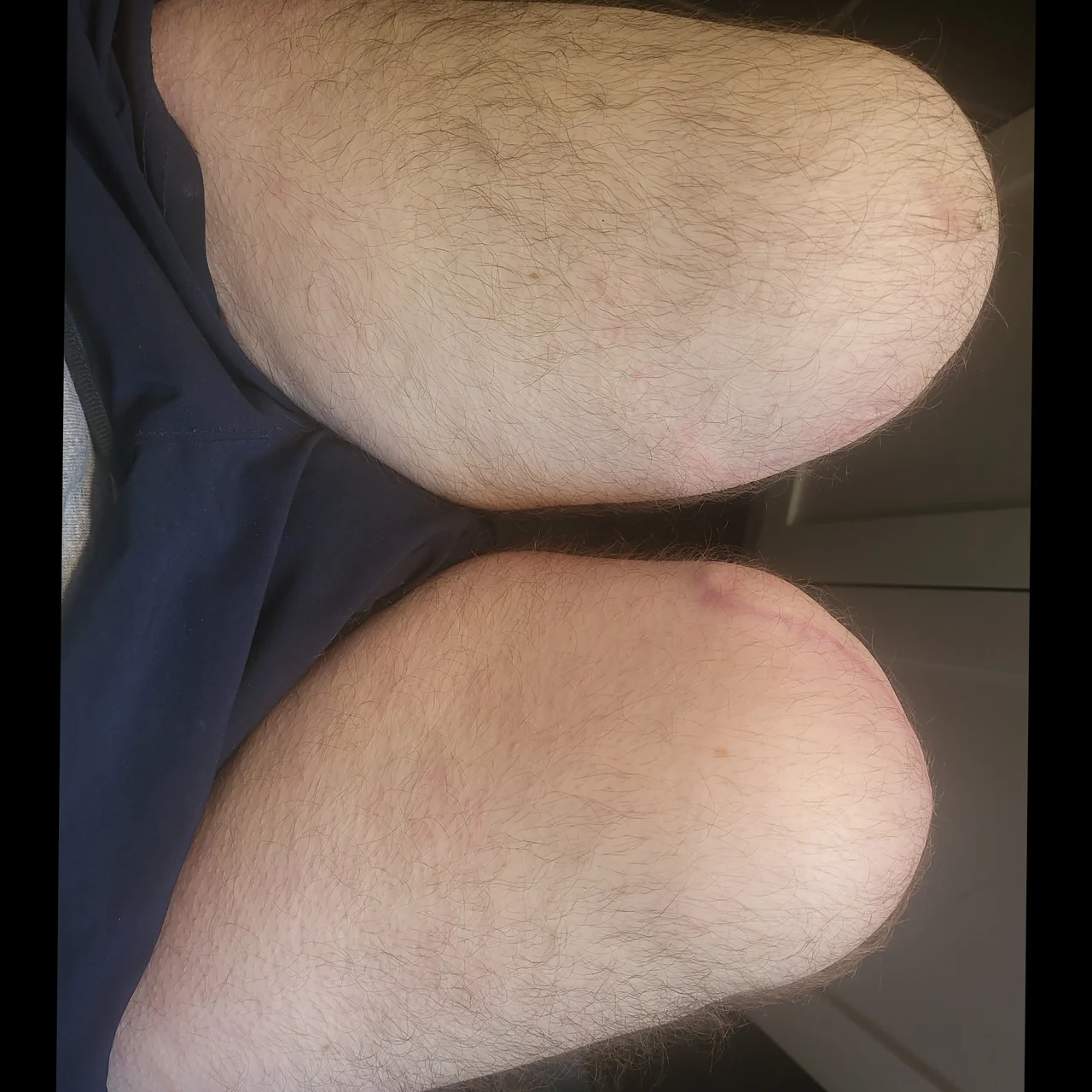 Bilateral Bo - OnlyFans model