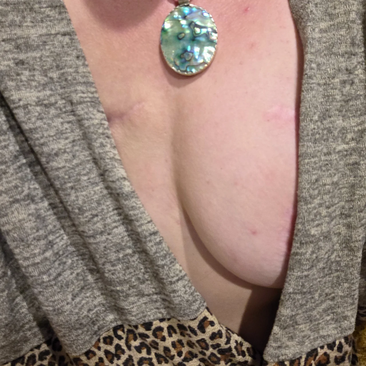 Slightly Mutilated Goddess - OnlyFans model