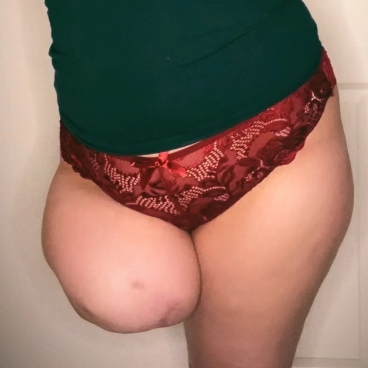 AmputeeDarling_FREE+ - OnlyFans model